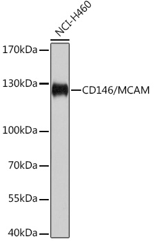 MCAM Polyclonal Antibody