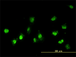 NEK11 Monoclonal Antibody [4E1-1F4] | EpigenTek