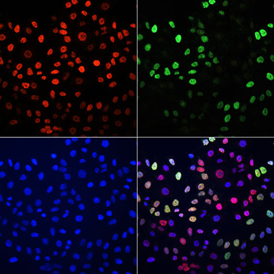 Histone H3K27me3 (H3K27 Trimethyl) Polyclonal Antibody | EpiGentek