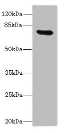 Western blot<br />All lanes: RAD17 Polyclonal Antibody at 12ug/ml+ Mouse thymus tissue<br />Goat polyclonal to rabbit at 1/10000 dilution<br />Predicted band size: 78, 76, 58, 67 kDa<br />Observed band size: 77 kDa<br />