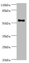 Western blot<br />All lanes: THRB Polyclonal Antibody at 2ug/ml+mouse liver tissue<br />Secondary<br />Goat polyclonal to rabbit at 1/10000 dilution<br />Predicted band size: 53, 55 kDa<br />Observed band size: 53 kDa<br />
