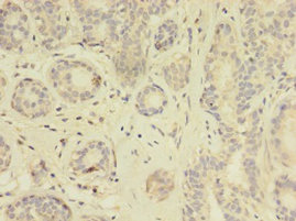 Immunohistochemistry of paraffin-embedded human thyroid tissue at dilution 1:100