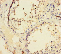 ZNF165 Polyclonal Antibody