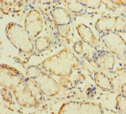 ZNF26 Polyclonal Antibody