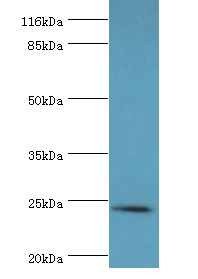 STXBP6 Polyclonal Antibody