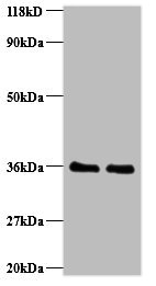 RPA2 Polyclonal Antibody