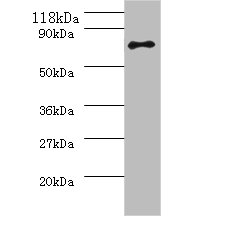 Western blot<br />All lanes: ureB Polyclonal Antibody at 2ug/ml+293T whole cell lysate<br />Secondary<br />Goat polyclonal to Rabbit IgG at 1/10000 dilution<br />Predicted band size: 62kDa<br />Observed band size: 62kDa<br />