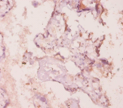 Mmp3 Polyclonal Antibody