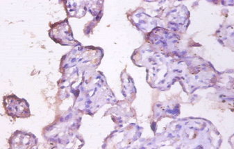 MUC1 Polyclonal Antibody