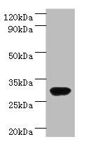Western blot<br />All lanes: rbsK Polyclonal Antibody at 2ug/ml+DH5? whole cell lysate<br />Secondary<br />Goat polyclonal to rabbit at 1/10000 dilution<br />Predicted band size: 32kDa<br />Observed band size: 32kDa<br />