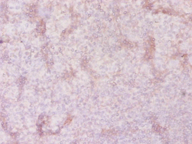 SLC41A2 Polyclonal Antibody