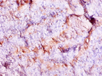 S100A9 Polyclonal Antibody