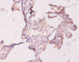 RHOA Polyclonal Antibody