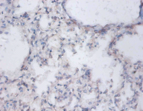 SLC26A1 Polyclonal Antibody