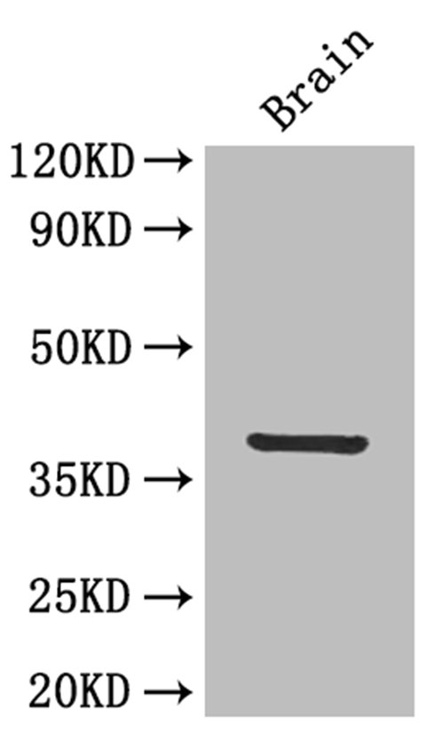 Western Blot<br />Positive WB detected in: mouse brain<br />All lanes: IL12 Polyclonal Antibody at 4ug/ml<br />Secondary<br />Goat polyclonal to rabbit IgG at 1/50000 dilution<br />Predicted band size: 37 kDa<br />Observed band size: 37 kDa<br />
