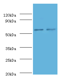 SCP2 Polyclonal Antibody