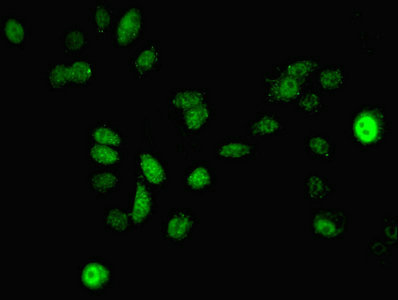 MAP2K3 Polyclonal Antibody | EpiGentek