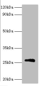Western blot<br />All lanes: Matrix protein Polyclonal Antibody at 2ug/ml+recombinant Matrix protein 0.1ug <br />Secondary<br />Goat polyclonal to Rabbit IgG at 1/10000 dilution<br />Predicted band size: 23kDa<br />Observed band size: 23kDa<br />
