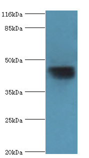 SERPINA6 Polyclonal Antibody