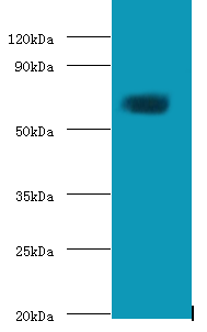 TGM2 Polyclonal Antibody