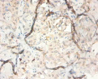 SERPINB3 Polyclonal Antibody