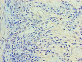 RAB11A Polyclonal Antibody
