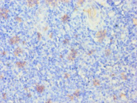 KRT14 Polyclonal Antibody