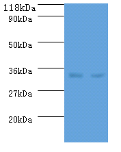 dcyD Polyclonal Antibody