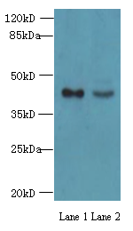 MAS1L Polyclonal Antibody