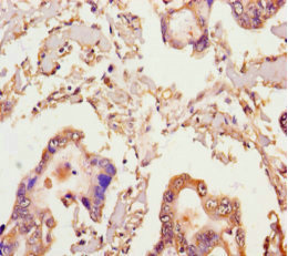 MICAL2 Polyclonal Antibody