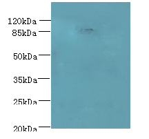 Western blot<br />All lanes: PASD1 Polyclonal Antibody at 4ug/ml+ A549 whole cell lysate<br />Goat polyclonal to rabbit at 1/10000 dilution<br />Predicted band size: 87 kDa <br />Observed band size: 87 kDa <br />