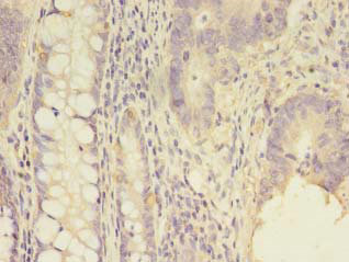 SCNN1G Polyclonal Antibody