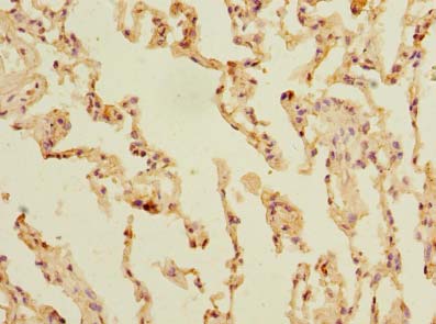 Immunohistochemistry of paraffin-embedded human skin tissue using SLC23A3 Polyclonal Antibody at dilution of 1:100