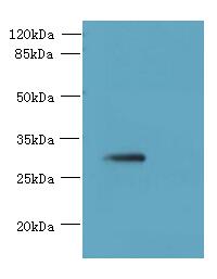 SLC25A4 Polyclonal Antibody