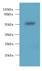 SLC38A2 Polyclonal Antibody