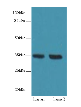 TMEM165 Polyclonal Antibody
