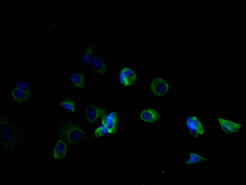 TMEM184B Polyclonal Antibody