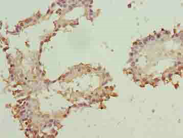 ZNF184 Polyclonal Antibody
