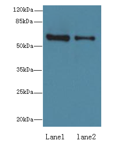 ZNF626 Polyclonal Antibody