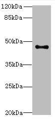 AADACL2 Polyclonal Antibody (100 µl)