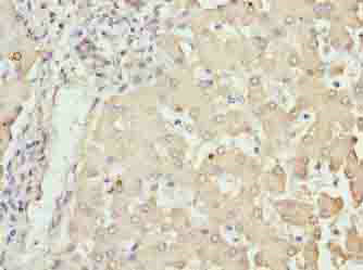 NUPL2 Polyclonal Antibody