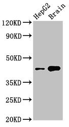 STK17B Polyclonal Antibody