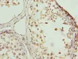 ZNF131 Polyclonal Antibody