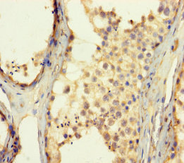ZNF454 Polyclonal Antibody