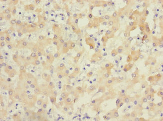ZNF462 Polyclonal Antibody