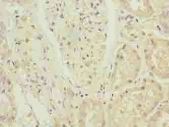 ZNF596 Polyclonal Antibody