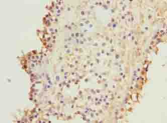 KIF26B Polyclonal Antibody