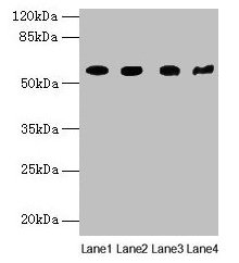 KRT79 Polyclonal Antibody