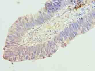 RINT1 Polyclonal Antibody