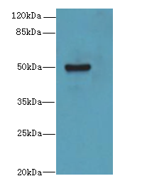 KRT80 Polyclonal Antibody